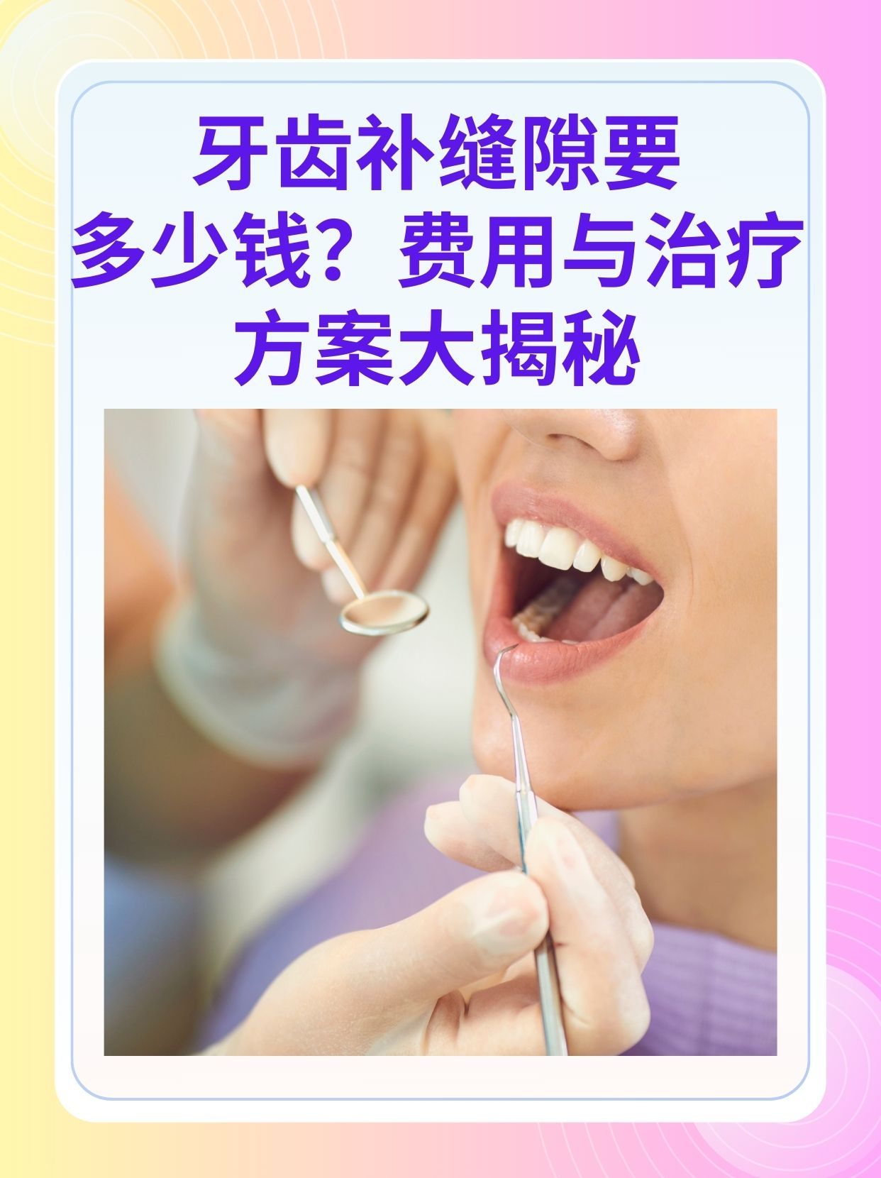 惠州补牙医保可以报销吗(补牙医保可以报销吗 哪些可以报销呢)